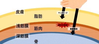 筋膜整体とマッサージを比較した筋肉の画像