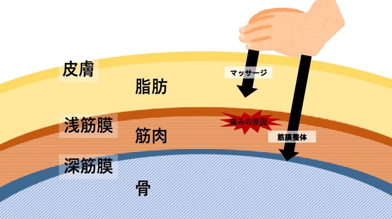 筋膜整体とマッサージを比較した筋肉の画像
